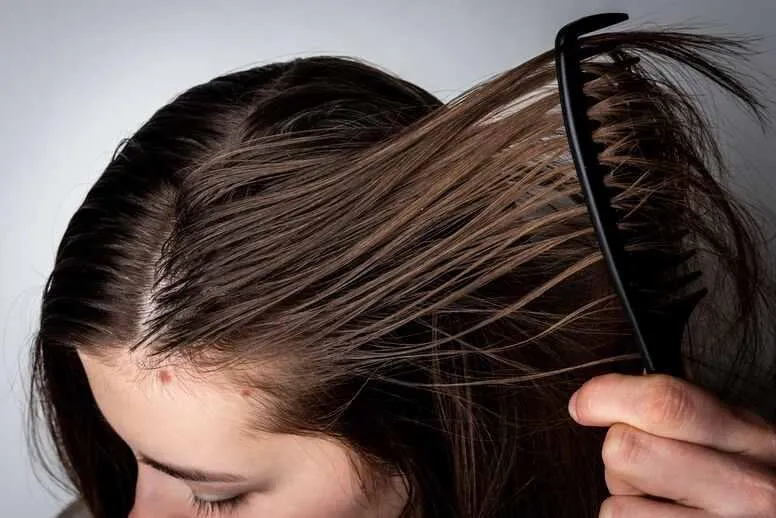 Przetłuszczające się włosy – jakie są przyczyny i jak dbać?