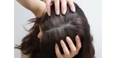 Siwienie włosów – jakie są przyczyny i czy można zahamować ten proces?