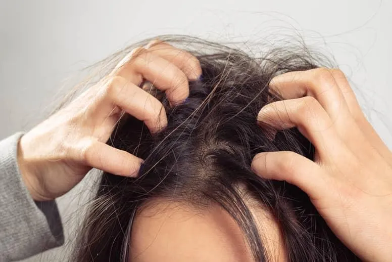 Sucha skóra głowy – jakie są przyczyny i objawy?